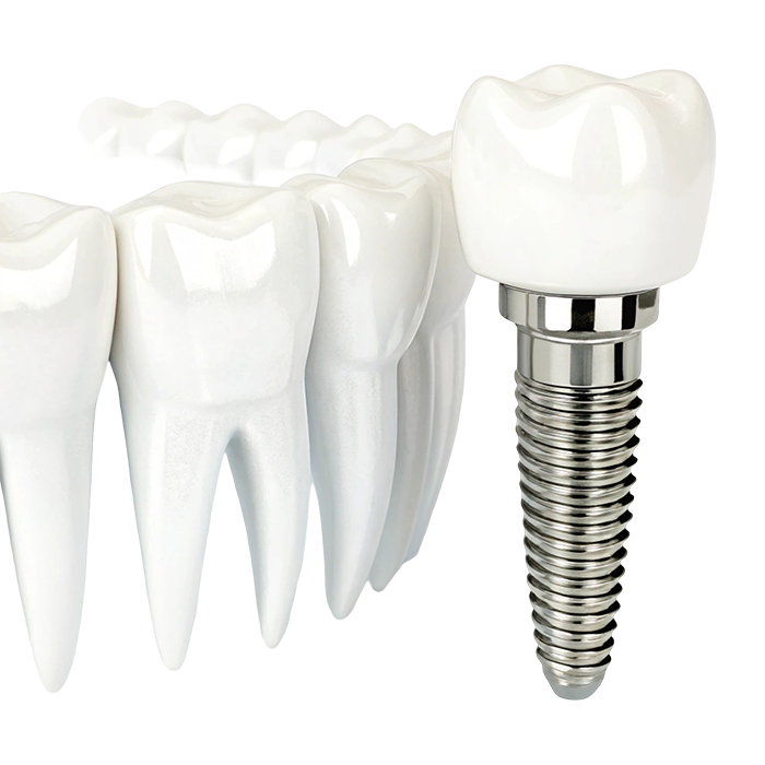 Dental Treatment