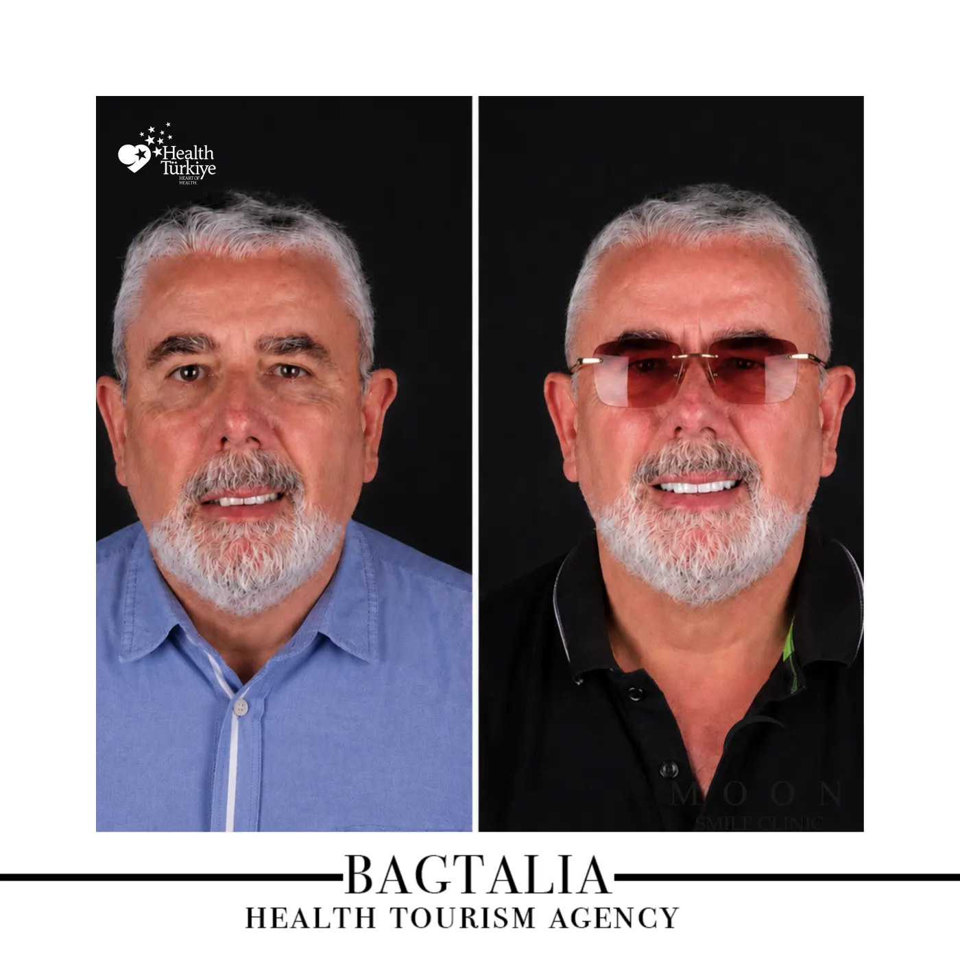 Moon Smile Clinic dental treatment result